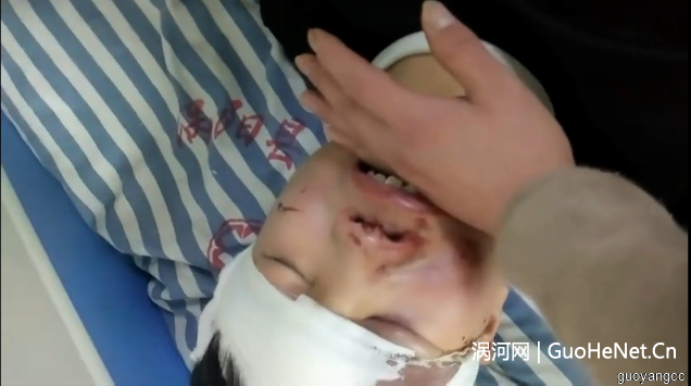 痛心！渦陽又一起學(xué)生墜樓，摔得滿臉是血，咋回事？ 